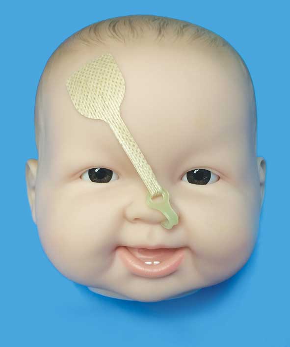 DynaCleft Nasal Elevators - 2x 7-Pack